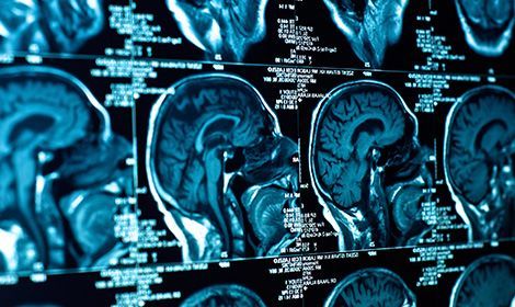 Featured Personal Injury Result